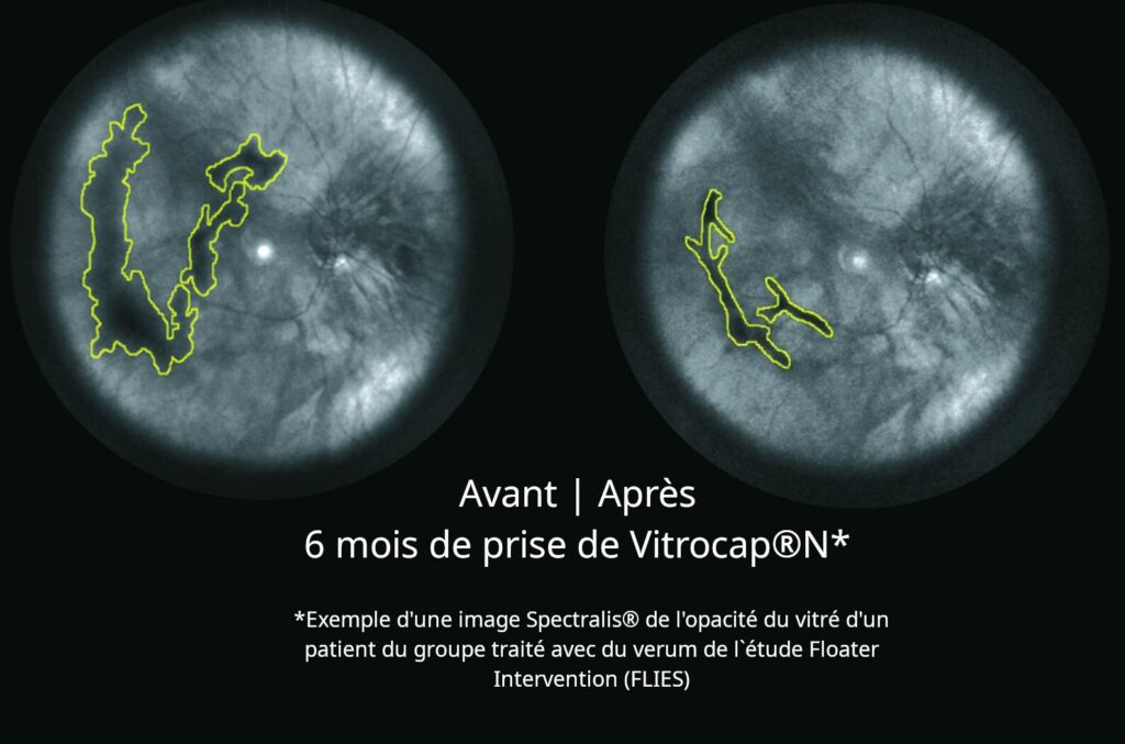 VitroCapN apres 6 mois