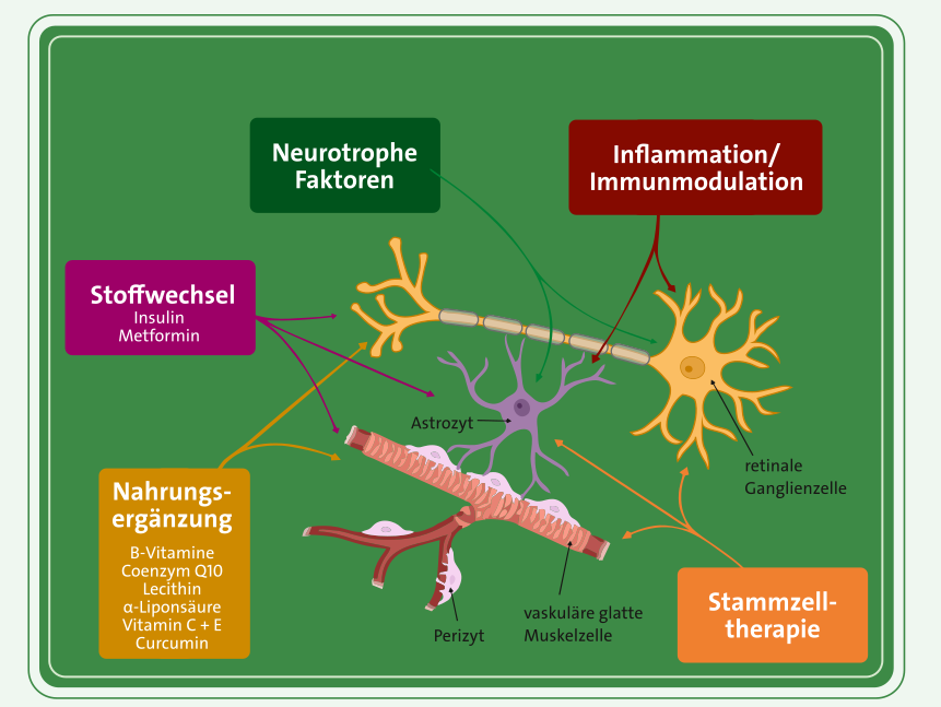 Glaukom Forschung Neuroprotektion